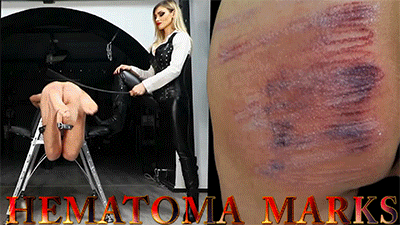MISTRESS ISIDE - HEMATOMA MARKS HD